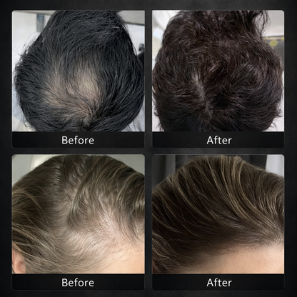 Shampoo Hair Care™